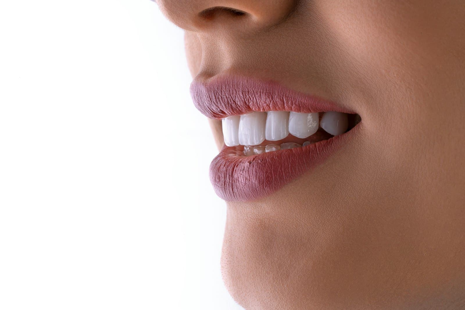 Teeth Whitening at Strupp & Brumm, Clearwater FL