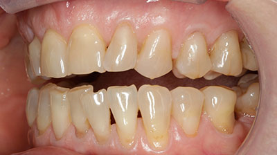 before after photo