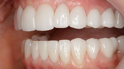 before after photo