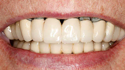 before after photo