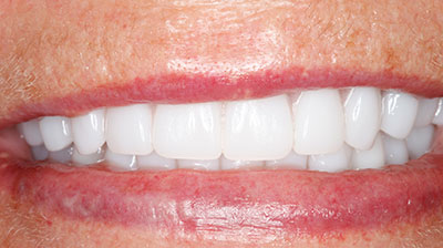 before after photo