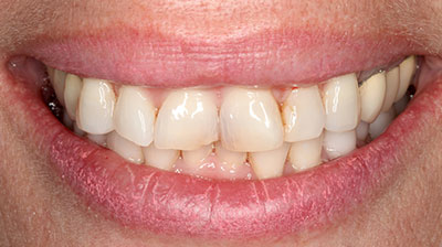 before after photo