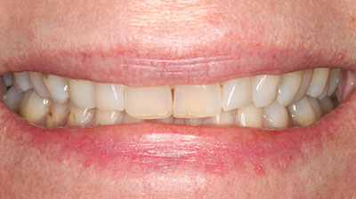 before after photo