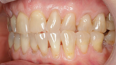 before after photo