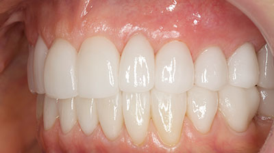 before after photo
