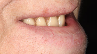 before after photo