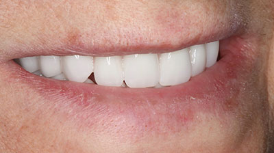 before after photo