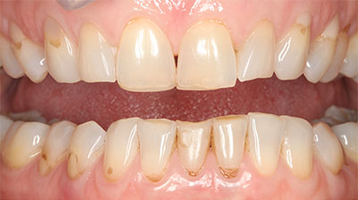 before after photo