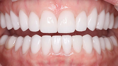 before after photo