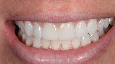 before after photo