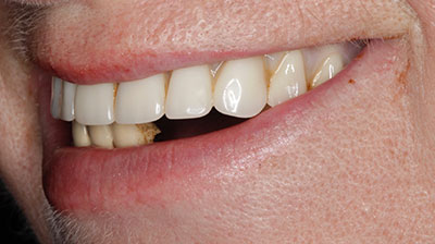 before after photo