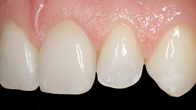 before after photo