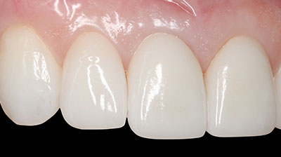 before after photo