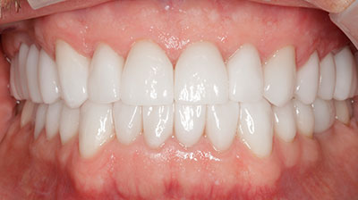 before after photo