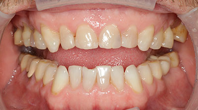 before after photo
