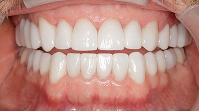 before after photo
