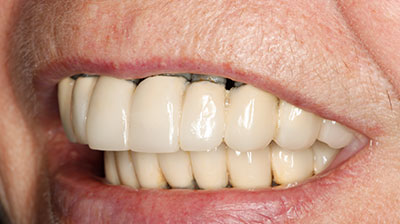 before after photo