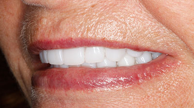 before after photo