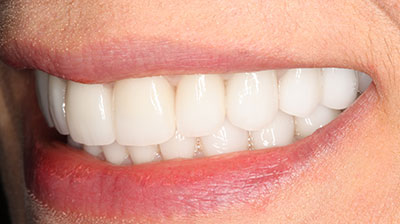 before after photo