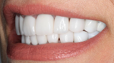 before after photo