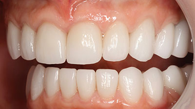 before after photo