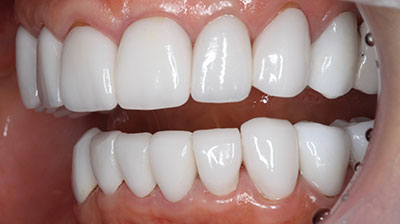 before after photo