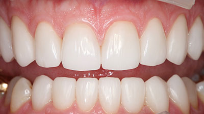 before after photo