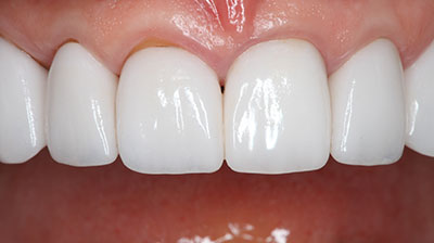 before after photo