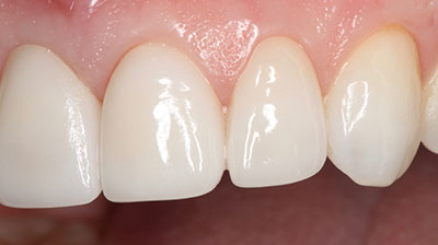 before after photo