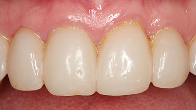before after photo