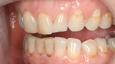 before after photo