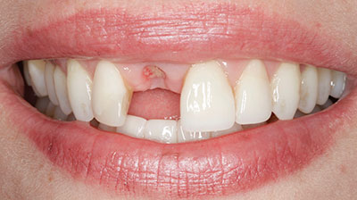 before after photo