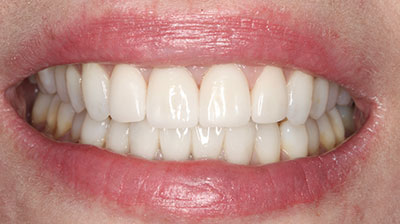 before after photo