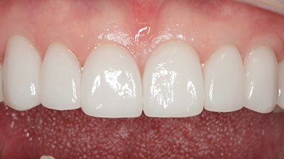 before after photo