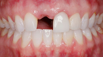 before after photo