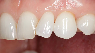 before after photo