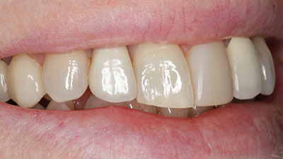before after photo