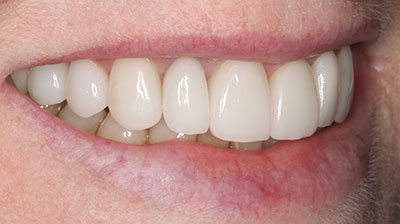 before after photo