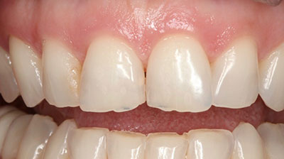 before after photo