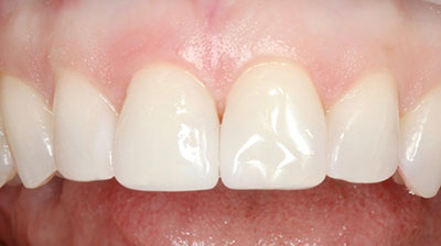 before after photo