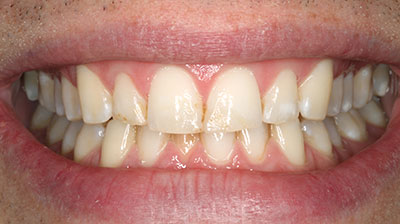 before after photo