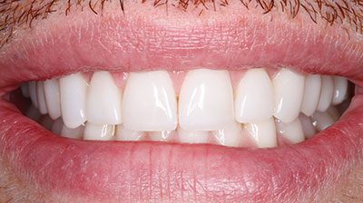 before after photo