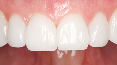 before after photo