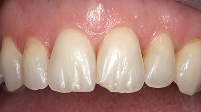 before after photo