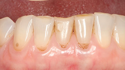 before after photo