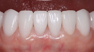 before after photo