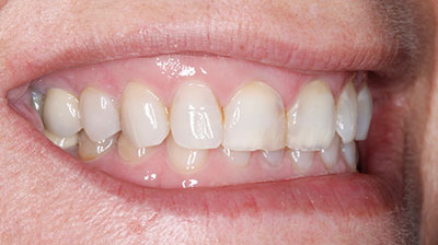 before after photo