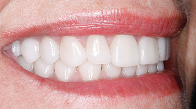 before after photo