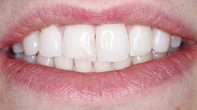 before after photo