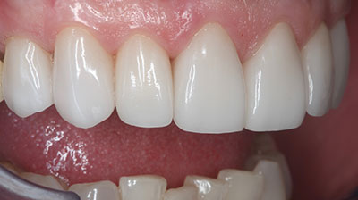 before after photo